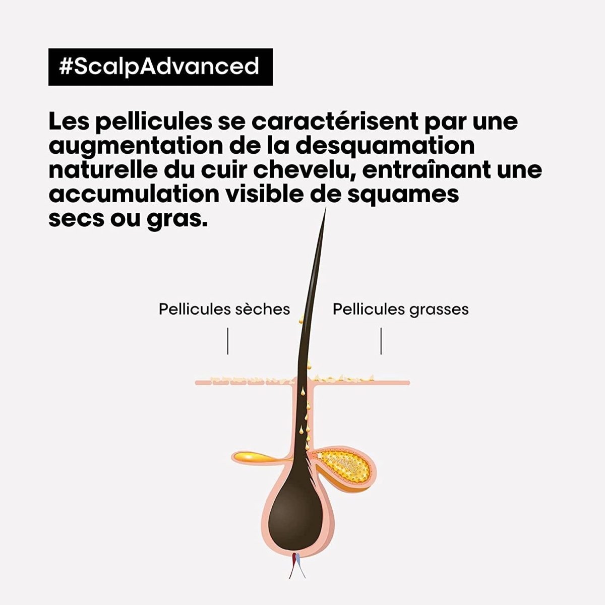 L'Oréal Professionnel Shampoing Scalp Advanced Anti-Pelliculaire 500ml - BEAUTEPRICE L'Oréal Professionnel Shampoing Scalp Advanced Anti-Pelliculaire 500ml L'Oréal Professionnel BEAUTEPRICE